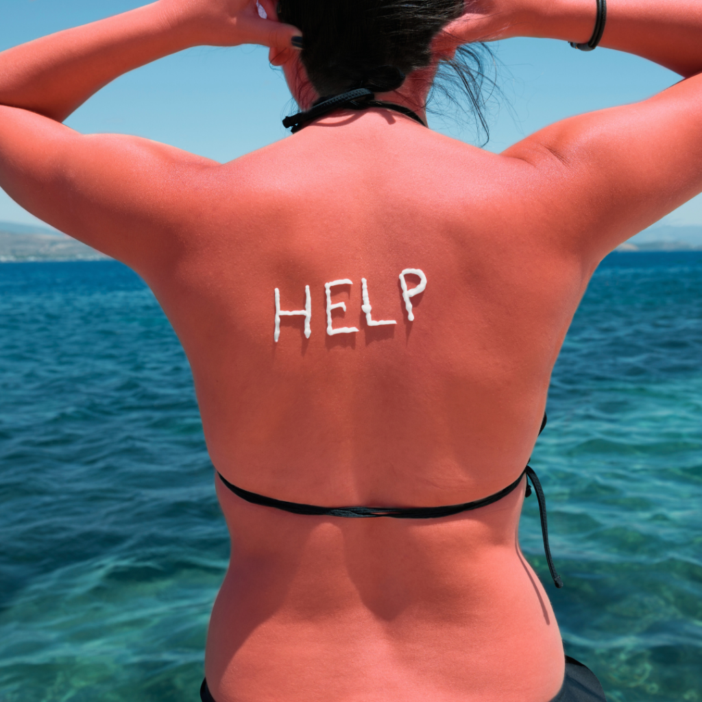 woman at ocean with a sunburn